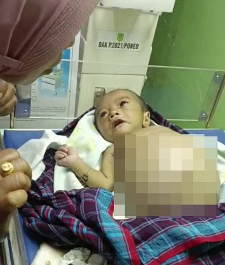 Bayi Malang Ibu Hesti 1